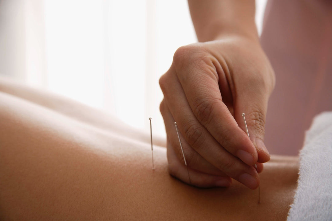 Unraveling the Mystery of Acupoints: A Groundbreaking Leap in Acupuncture Research